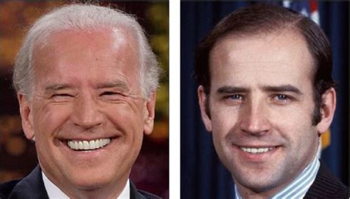 Joe Biden Facelift: Did He Get Plastic Surgery Done?