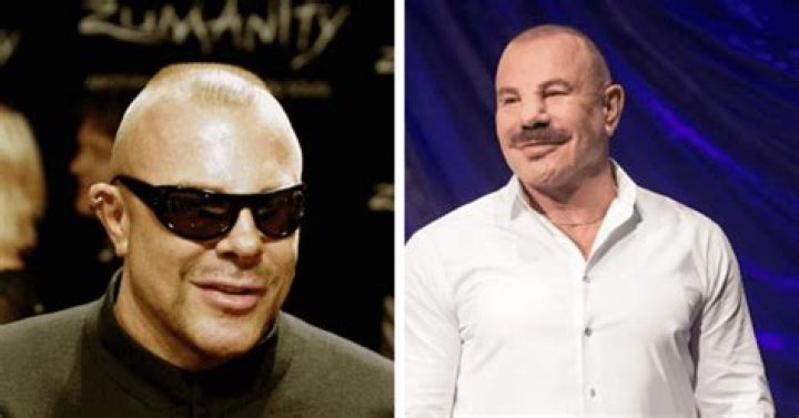 
Manfred Thierry Mugler Gym Accident; Did He Have Face Surgery Photos Exposed 